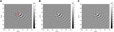 Ultrasonic Ring Array-Based Transient Triplet Differential Photoacoustic Imaging for Strong Background Removal